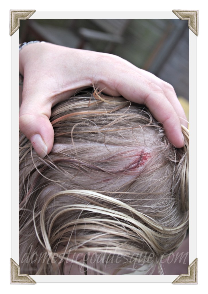 head trauma head trauma